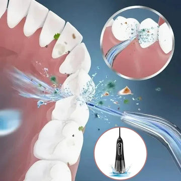 Tragbare Munddusche - OralJet