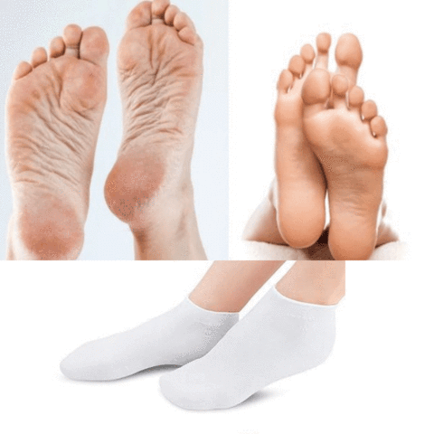 Damen-Silikonsocken zur Feuchtigkeitspflege für Füße und Ferse