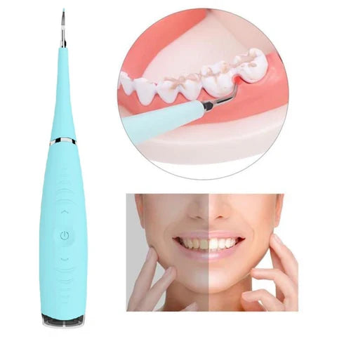 Zahnstein- und Schmutzentferner - Dental